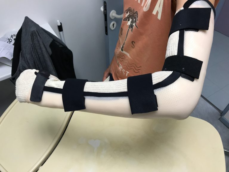 Fracture du coude L'Orthesiste.fr